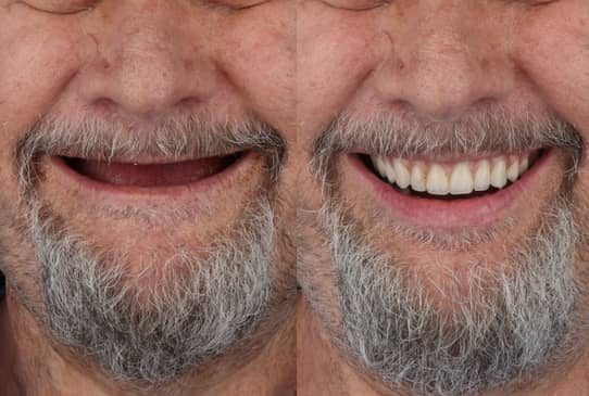 Slider image (1) The Dental Corner